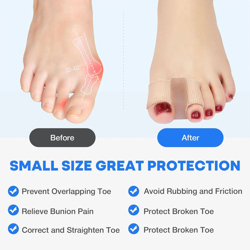 Toe Separator & Bunion Corrector 🦶